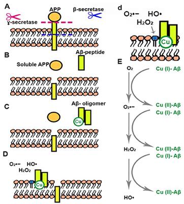 Redox signaling and metabolism in Alzheimer's disease